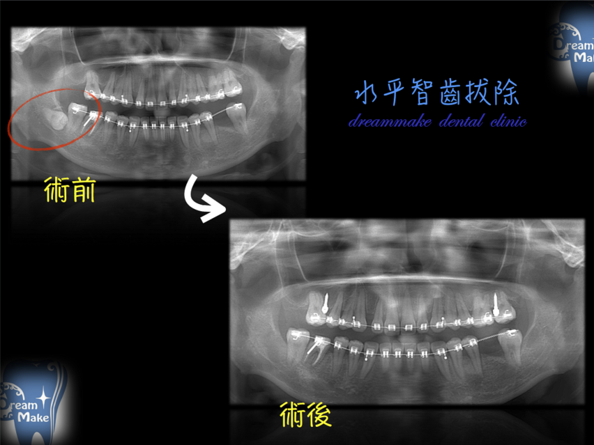 口腔外科